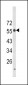 LAG3 Antibody (Center)